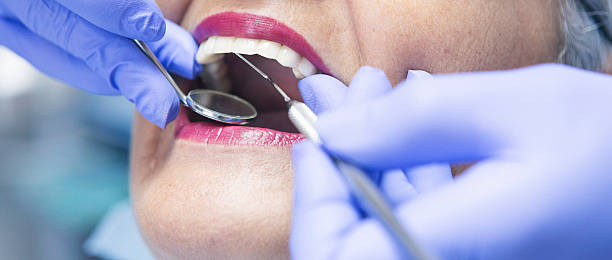 Best Chipped Tooth Repair Near Me  in Maple Glen, PA